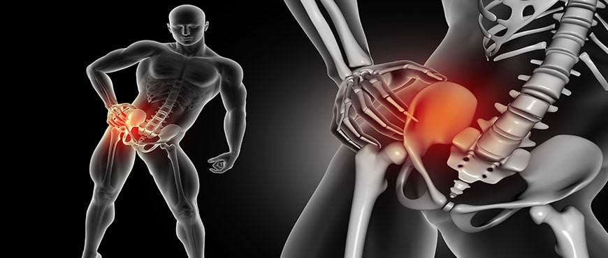 Osteopatia y problemas de Cadera