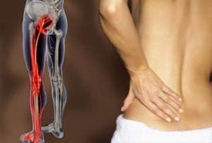 causas de la ciática tratarlo con Osteopatía en Vallecas